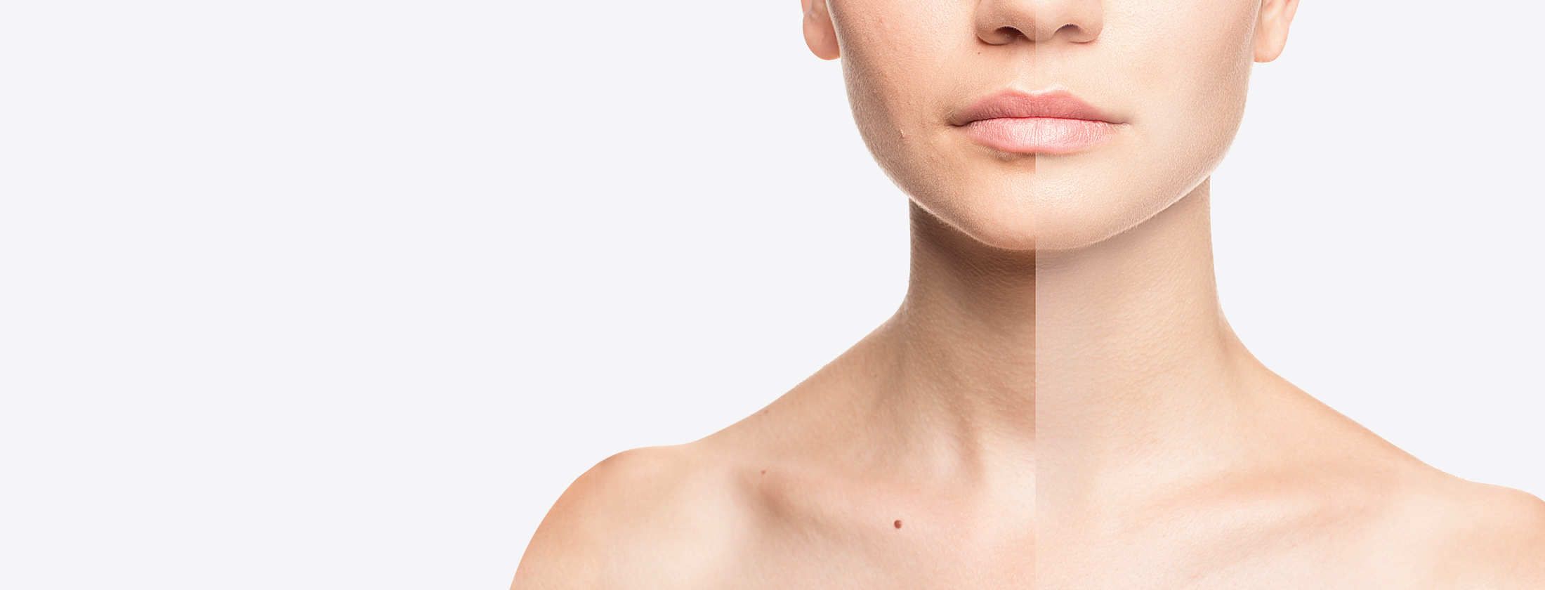 Makellose Haut einer Frau nach einer Microneedling-Behandlung zur Hautverjüngung und Hautbildverbesserung. Abgebildet sind Hautpartien am Hals. Die eine Seite sieht etwas faltig aus. Die andere verjüngt nach professioneller Hautbehandlung in Frankfurt.